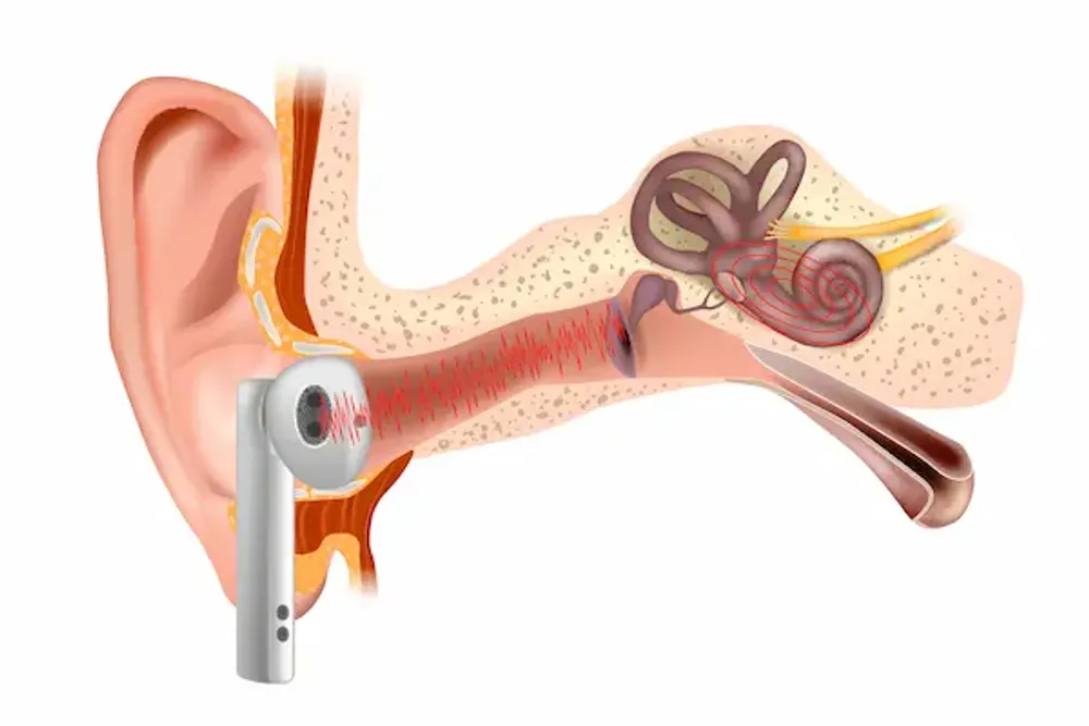 Hearing Aids