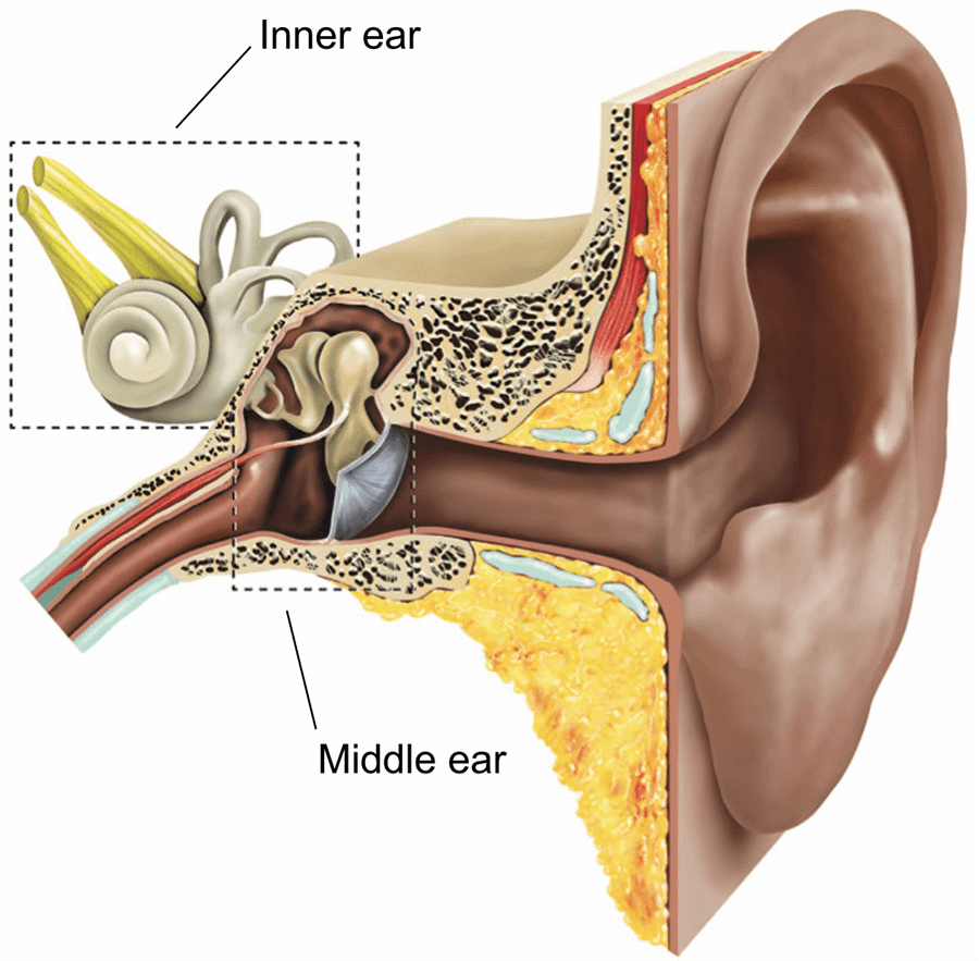 Stapedectomy Treatment