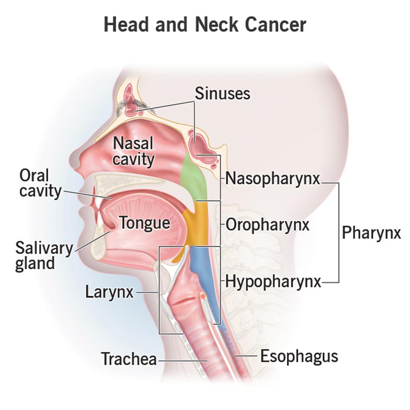 Cancer Treatment